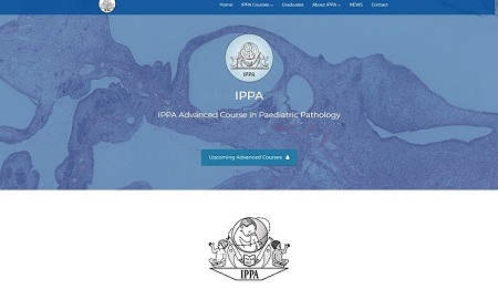 IPPA